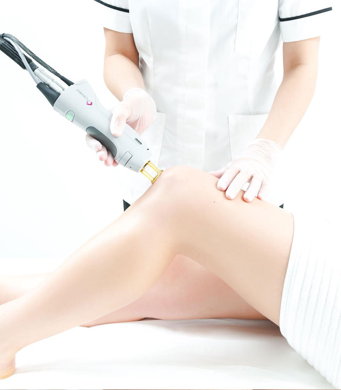 The Science Behind Laser Hair Removal